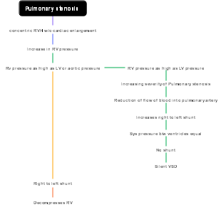 Pulmonary Stenosis Pathophysiology Flowchart