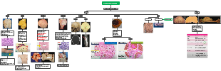 Mesenchymal Neoplasms