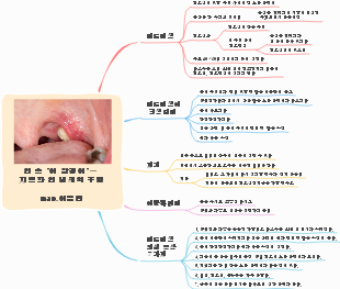 How Lingering Mouth Particles Take Center Stage in Bad Breath Woes