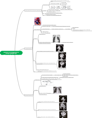 Carte mentale du développement anormal du système cardiaque droit