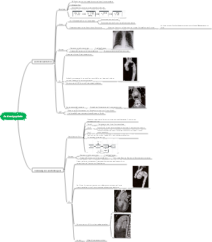 Mindmap zur Aortendysplasie