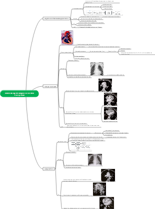 Mindmap der abnormalen Entwicklung des rechten Herzsystems