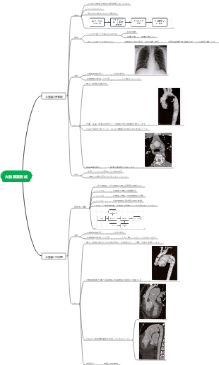 大動脈異形成マインドマップ