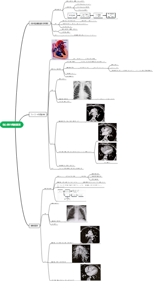 右心系の異常発達のマインドマップ