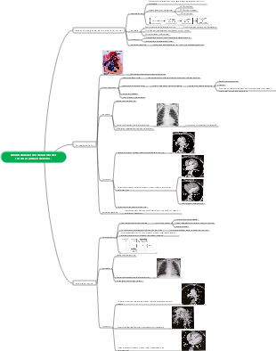 Mapa mental del desarrollo anormal del sistema cardíaco derecho