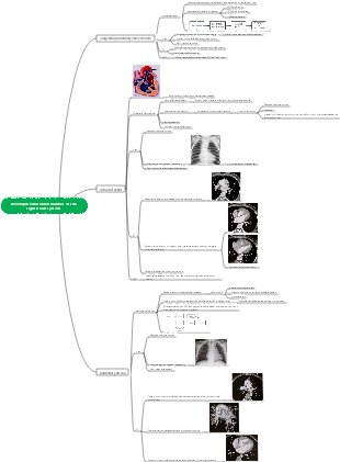 Mind map of abnormal development of the right heart system