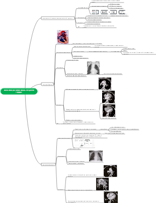 Интеллект-карта аномального развития правой сердечной системы