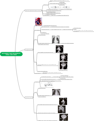 Mapa mental do desenvolvimento anormal do sistema cardíaco direito