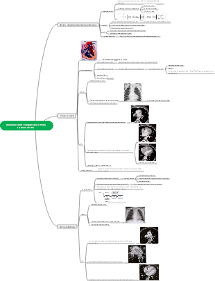 Mappa mentale dello sviluppo anormale del sistema cardiaco destro